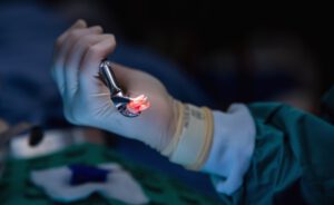 extractions